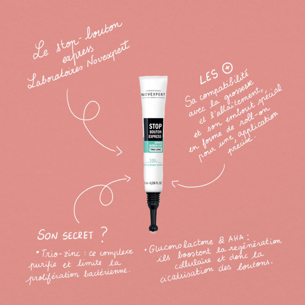 Guide : Les stop-boutons slide 1