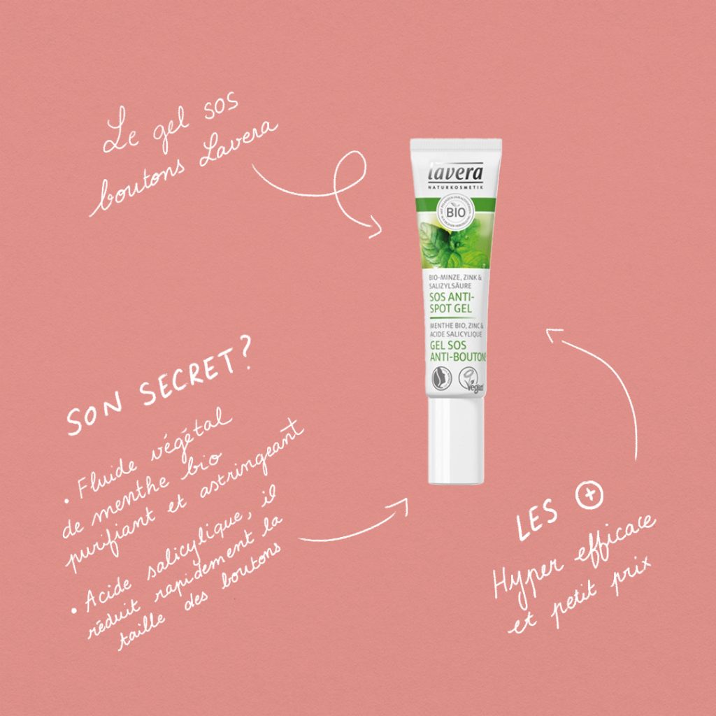 Guide : Les stop-boutons slide 5