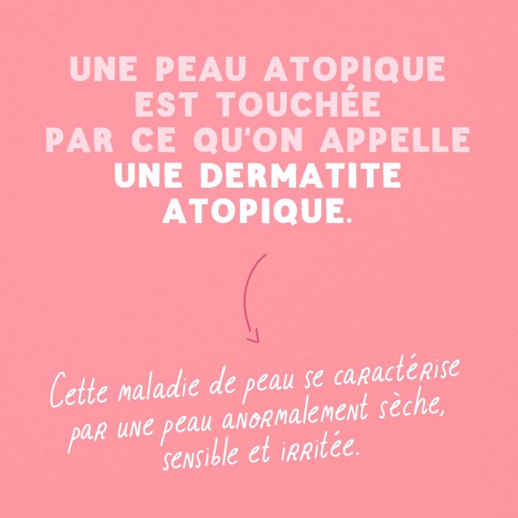 Guide : Qu’est-ce qu’une peau atopique ? slide 1