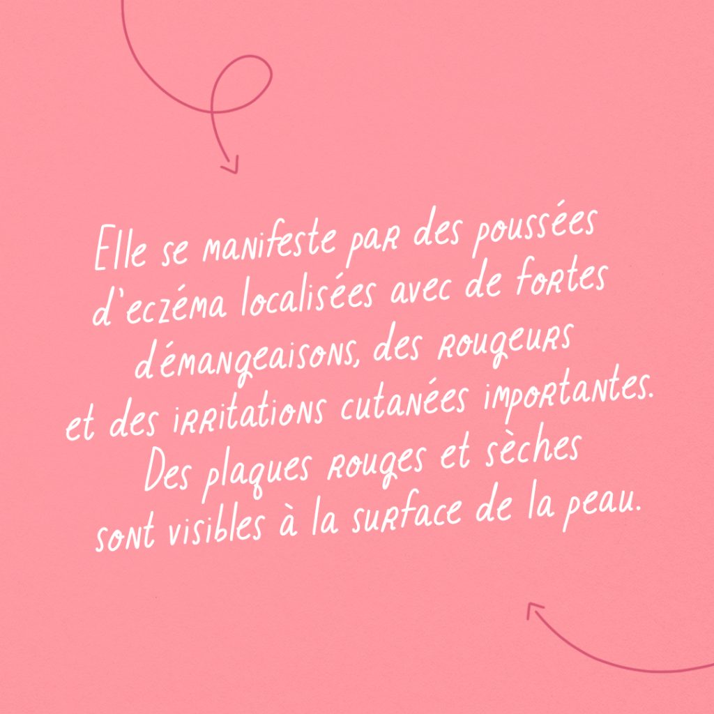 Guide : Qu’est-ce qu’une peau atopique ? slide 2