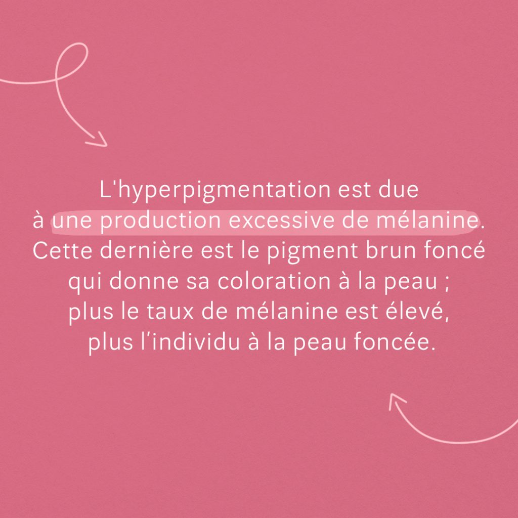 Guide : Les meilleurs produits pour atténuer les taches pigmentaires slide 1