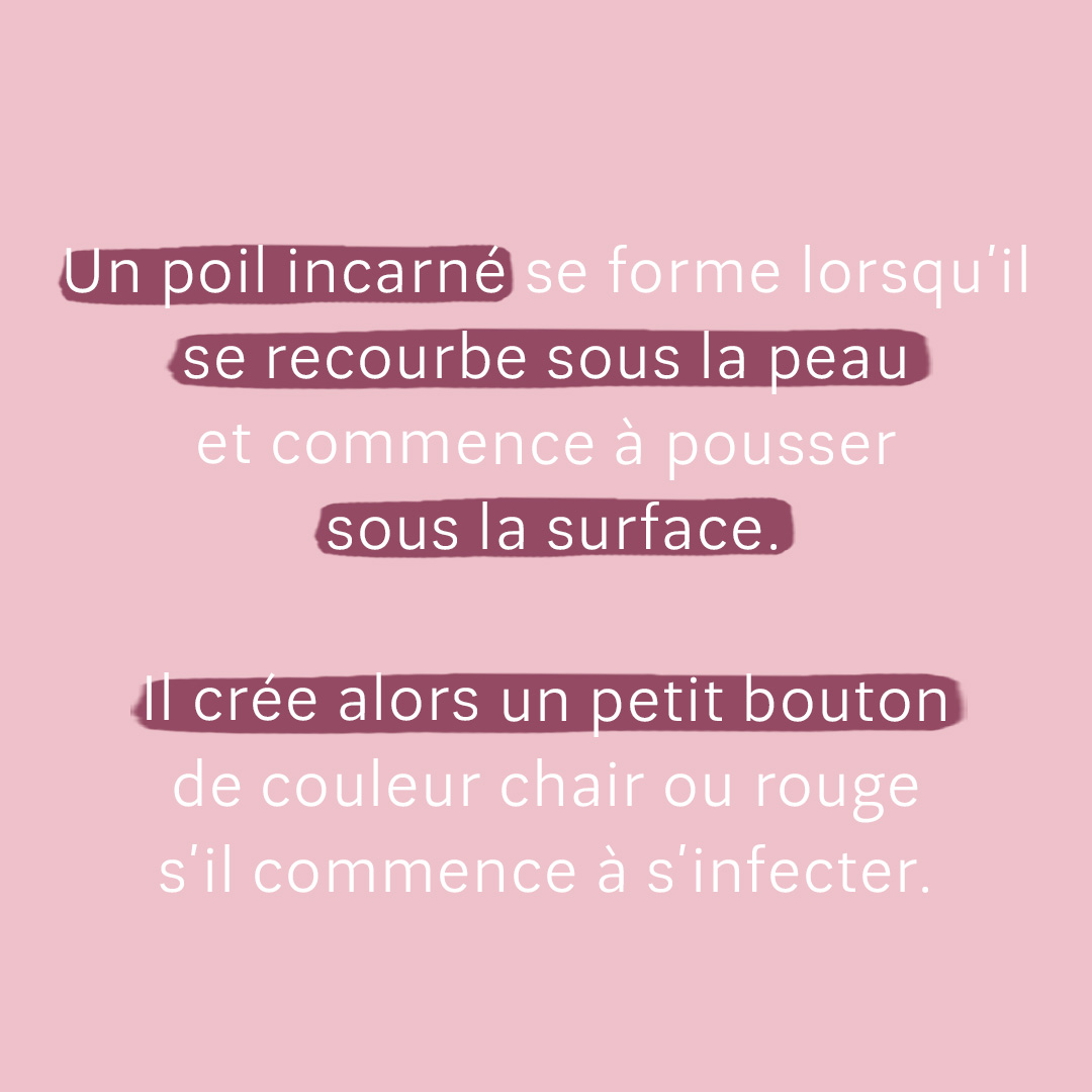 qu'est-ce qu'un poil incarné